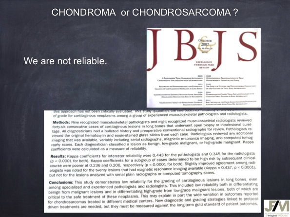 Mistakes in diagnosing of a Bone Tumor