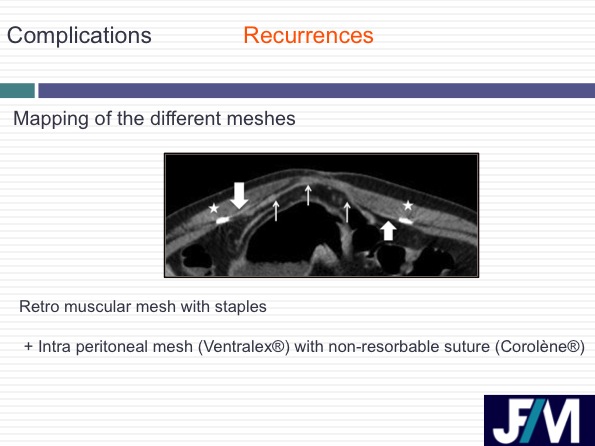 CT findings after abdominal wall repair surgery