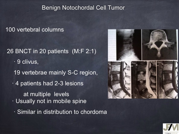 Mistakes in diagnosing of a Bone Tumor